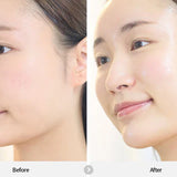 REJURAN Dual Effect Ampoule 30ml