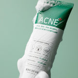 Some By Mi - AHA, BHA, PHA 30 Days Miracle Acne Clear Foam 100ml