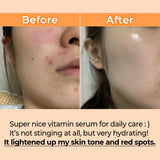 Numbuzin - No.5 Goodbye Blemish Serum 50ml