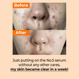 Numbuzin - No.5 Vitamin Concentrated Serum 30ml
