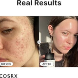 COSRX - The Niacinamide 15 Serum 20ml