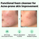 Some By Mi - AHA, BHA, PHA 30 Days Miracle Acne Clear Foam 100ml