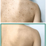 Some By Mi - AHA, BHA, PHA 30 Days Miracle Acne Clear Body Cleanser 400g