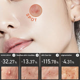 Anua - Heartleaf Centella Red Spot Cream 30g