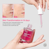 Anua - Niacinamide 10% + TXA 4% Dark Spot Correcting Serum 30ml