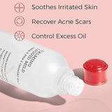 COSRX - AC Collection Calming Liquid Mild 125ml