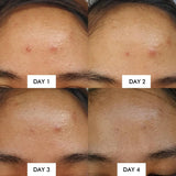 Some By Mi - AHA BHA PHA 14 Days Super Miracle Spot All Kill Cream 30ml