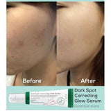 AXIS-Y Dark Spot Correcting Glow Serum 50ml