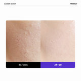 FRANKLY Closer Pore Reducing Serum 30ml